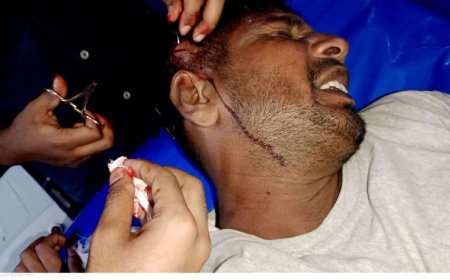 শ্যামনগরের গাবুরায় স্লুইস গেটে পানি সরবরাহ নিয়ে বিরোধে জখম ২