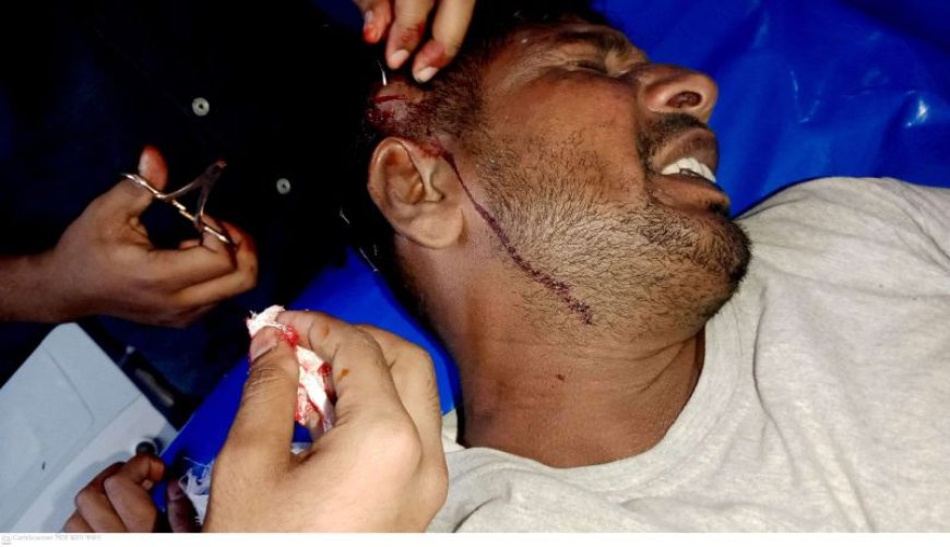 শ্যামনগরের গাবুরায় স্লুইস গেটে পানি সরবরাহ নিয়ে বিরোধে জখম ২