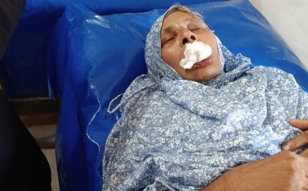 মায়ের দাঁত ভাঙলো ছেলে!