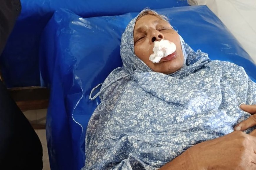 মায়ের দাঁত ভাঙলো ছেলে!